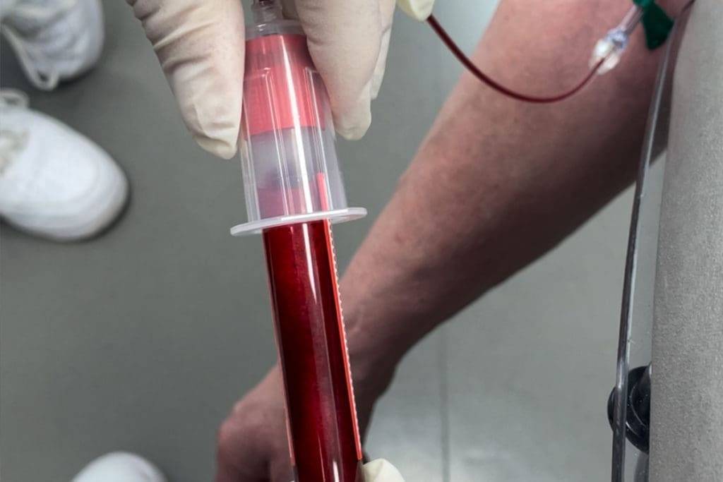 Eigenbluttherapie 2 Eigenbluttherapie 1